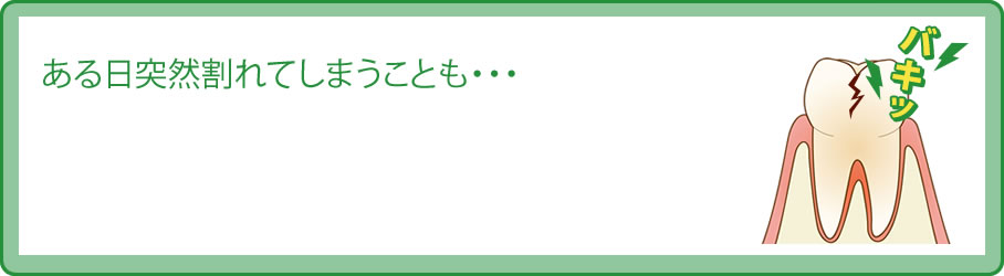 ある日突然割れてしまうことも・・・